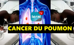 DEMANDE D'AIDE - CETTE JEUNE FILLE DE 19ANS SOUFFRE DE LA MALADIE DU CANCER DU POUMON