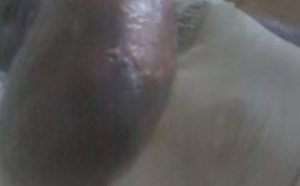 Gambie: Des marins chinois aspergent un pêcheur sénégalais d’essence avant de le...transformer en torche humaine (Photos)