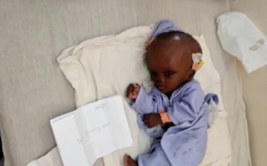 Appel à la solidarité: Leur bébé souffrant d’hydrocéphalie dans l'attente d'une opération, une famille sollicite un soutien d’urgence