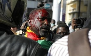 Victimes des violences policières lors du processus électoral de 2012 : Vers une indemnisation des victimes par l’Etat du Sénégal.