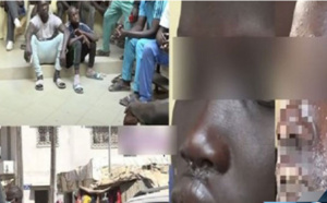 Maladie mystérieuse: Abdou Karim Sall soupçonne qu'elle soit d’origine algale