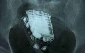 Un détenu trahi par la sonnerie du portable dissimulé dans... son corps