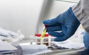 Lutte contre les maladies tropicales négligées à Ziguinchor : des suspicions sur la COVID-19 perturbe la campagne