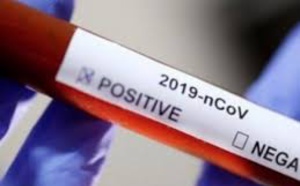 Covid-19: Le prix des tests rapides divisé par deux pour les pays en développement
