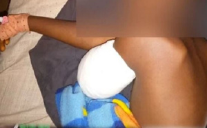 Manifestations de soutien à Ousmane Sonko: L’élève amputé du bras est sorti de l’hôpital