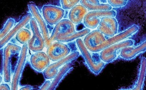 Maladie à virus de Marburg: Un premier cas confirmé en Guinée