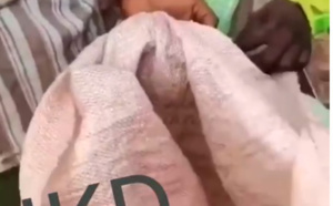 Pikine Texaco: Un bébé de 7 mois retrouvé dans un sac, jeté dans un camion d'ordures par...