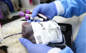 Hépatite B: 10% de la population sénégalaise infectés