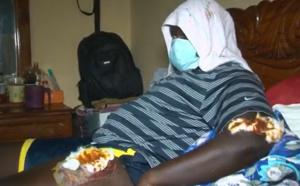 Cité Biagui / Supposée attaque chez Sonko: Un suspect battu, torturé, avec des blessures graves