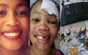 Un homme arrache les dents de sa petite amie avec une pince, pour avoir détruit ses biens