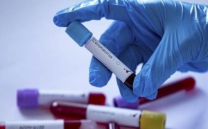 Variant Omicron: Le Sénégal "tient" son premier cas positif (Iressef)