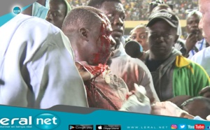 Le sang, les agressions à armes blanches: Cette autre face hideuse de la lutte sénégalaise