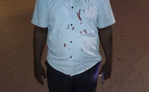 Agression d'Ousmane Coly: Abdou Sané de Pastef /Ziguinchor accuse le camp de Baldé