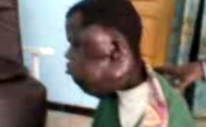 Vidéo - "Leral Aide et Action" : Après une bagarre, Abdoulaye Djimbira se retrouve avec un visage défiguré et un cou boursouflé