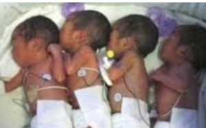 Hôpital régional de Kaolack : une jeune maman donne naissance à des quadruplés