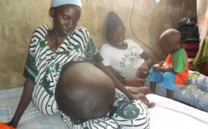 Photos - Comment Ndoye Bane a sauvé cette femme atteinte d'une étonnante maladie