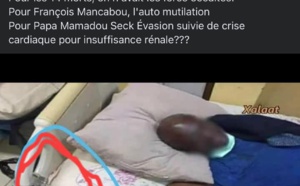 Cette photo publiée sur les réseaux sociaux n'est pas celle de François Mancabou : C'est celle d'un détenu anglophone décédé en 2020 au Cameroun