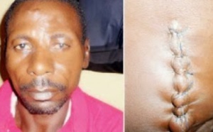 Nigéria : Il tue sa deuxième femme pour lui avoir sciemment transmis le Sida