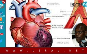 Leral Santé - Maladies cardio-vasculaires : Causes, symptômes et méthodes thérapeutiques