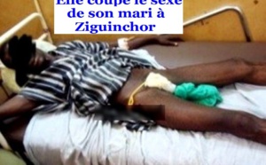 Ziguinchor : Une jeune mariée sectionne le sexe de son époux