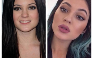 Comment Kim Kardashian explique les lèvres gonflées de sa petite soeur