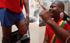 Urgence signalée : Venu voir Ousmane Sonko, Guy Marius Sagna blessé au genou par une grenade lacrymogène