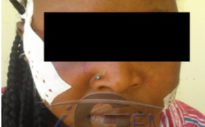 Images: Le journaliste M.G bastonne et défigure sa "aawo" avec la complicité avec sa "niaréél"
