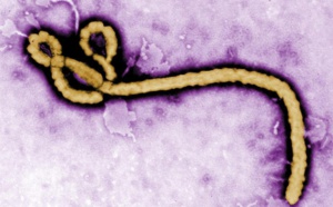 Alerte: Un échantillon de virus Ebola volé en Guinée