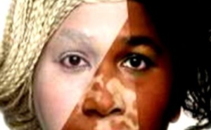 Dépigmentation artificielle : L’Etat au banc des accusés