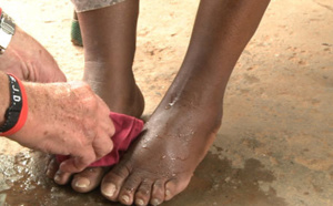 Comment se débarrasser d’un cor au pied