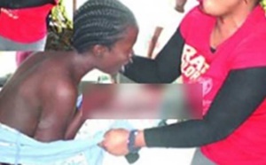 Nigeria: Une mère arrache l’oreille de sa fille pour avoir couché avec son copain