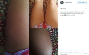 Oui, la cellulite et les vergetures, c'est NORMAL ! Cette nouvelle tendance sur le web est en train de décomplexer enfin toutes les femmes...