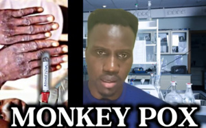 « Arme biologique/ Comment se transmet la variole du singe, symptômes, traitement », Par Amadou H Ly