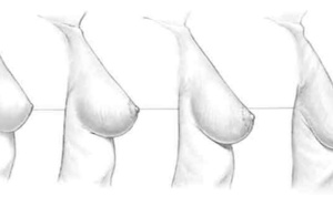 Voici comment prévenir l’affaissement des seins naturellement