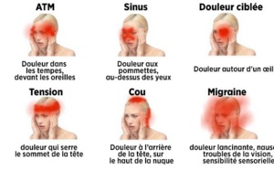 Apprenez à reconnaître les maux de tête dangereux