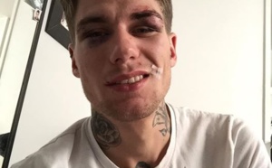 Un couple raconte sur Facebook avoir été « tabassé par des homophobes »