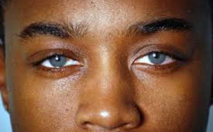 Si vous tenez à vos yeux, ne faites pas ces 5 choses