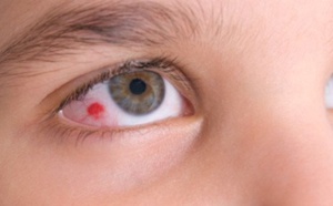 9 Signes que vous avez un problème aux yeux
