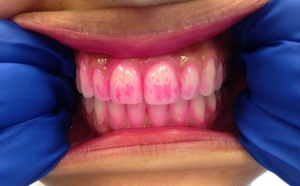 8 choses que vous ne saviez peut-être pas sur vos dents