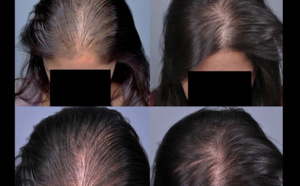 Pour des cheveux qui poussent rapidement, essayez le secret des Indiennes !