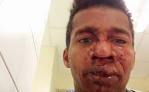 La police accusée de violences sur ce jeune homme en Vendée