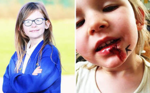 La petite fille qui ne mange pas, ne dort pas et ne ressent pas la douleur