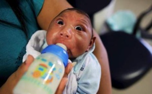 Bébés malformés: et si Zika n'était pas en cause?