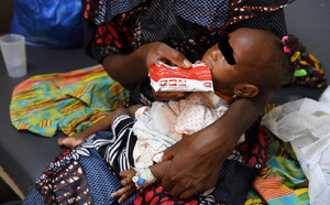 Diourbel face à une crise nutritionnelle : Plus de 50 000 enfants en danger