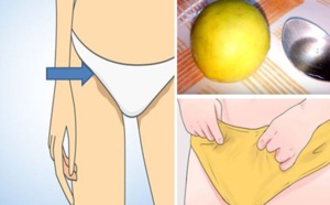 Voici comment éclaircir la peau sombre du pubis et entre les jambes avec un seul ingrédient