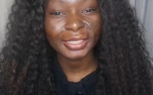 Cette ancienne grande brûlée est une incroyable maquilleuse