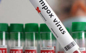 Mpox au Sénégal : Le seul patient recensé est totalement guéri, plus de cas actif de Mpox, vigilance maintenue par le ministère