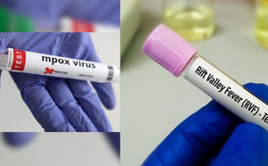 Épidémies : 78 cas de Fièvre de la Vallée du Rift et 5 cas de Mpox recensés à la date du 3 octobre 2025