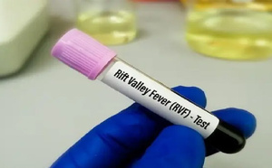 FVR et Mpox : 5 nouveaux cas et 1 décès : La situation sanitaire sous surveillance au Sénégal, le ministère renforce l'alerte sanitaire