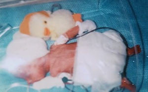 Lors de la naissance de cet enfant, personne ne savait ce qu’il deviendrait 2 ans plus tard. Absolument incroyable.